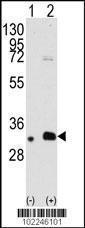 Anti-MAGEB2 Rabbit Polyclonal Antibody (APC (Allophycocyanin))