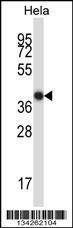 Anti-LDB2 Rabbit Polyclonal Antibody (APC (Allophycocyanin))