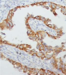 Anti-TNFA Rabbit Polyclonal Antibody