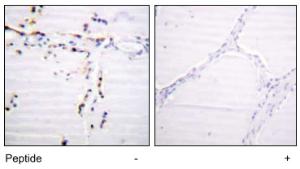 Anti-ACO1 Rabbit Polyclonal Antibody