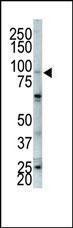 Anti-FGFR2 Rabbit Polyclonal Antibody (Biotin)