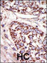 Anti-MAPK3 Rabbit Polyclonal Antibody