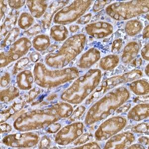 Immunohistochemistry analysis of paraffin-embedded mouse kidney using Anti-PPP1R3C Antibody (A307722) at a dilution of 1:50 (40X lens). Perform high pressure antigen retrieval with 10 mM citrate buffer pH 6.0 before commencing with IHC staining protocol