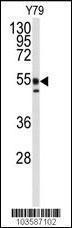 Anti-PACSIN1 Rabbit Polyclonal Antibody (AP (Alkaline Phosphatase))