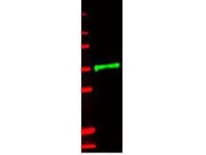 AntiHMN IL-1 receptor type II 1M