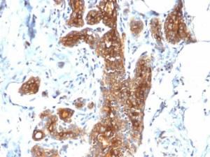 Anti-MUC1 Rabbit Recombinant Antibody [clone: MUC1/2278R]