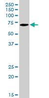 Anti-PADI4 Goat Polyclonal Antibody