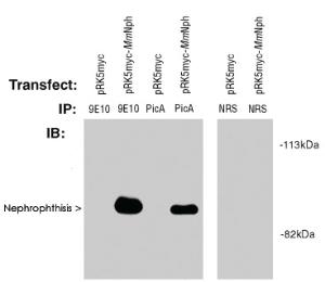 Anti-Nephronophthisis (pic) Rabbit Polyclonal Antibody