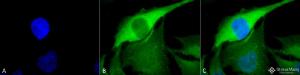 Immunocytochemistry/Immunofluorescence analysis of human heat shocked cervical cancer cell line (HeLa), fixed in 2% formaldehyde for 20 minutes at room temperature, using Anti-HSP70 Antibody (A304824), at 1:100 for 12 hours at 4°C