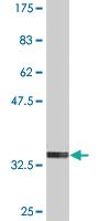 Anti-FOLR2 Mouse Monoclonal Antibody [clone: 4B12]