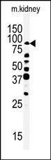 Anti-RIPK4 Rabbit Polyclonal Antibody (FITC (Fluorescein))