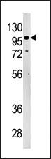 Anti-LLGL2 Rabbit Polyclonal Antibody