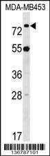 Anti-LDB3 Rabbit Polyclonal Antibody (APC (Allophycocyanin))