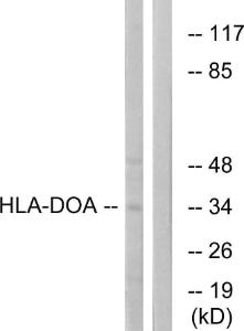 Western blot analysis of lysates from COLO cells using Anti-HLA-DOA Antibody. The right hand lane represents a negative control, where the antibody is blocked by the immunising peptide.