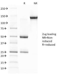 SDS-PAGE analysis of Anti-Glycophorin A Antibody [JC159] under non-reduced and reduced conditions; showing intact IgG and intact heavy and light chains, respectively. SDS-PAGE analysis confirms the integrity and purity of the antibody