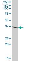 Anti-RCHY1 Mouse Polyclonal Antibody