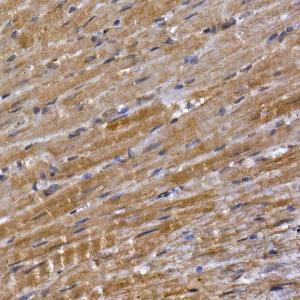 Immunohistochemistry analysis of paraffin-embedded mouse heart using Anti-PPP1R3C Antibody (A307722) at a dilution of 1:50 (40X lens). Perform high pressure antigen retrieval with 10 mM citrate buffer pH 6.0 before commencing with IHC staining protocol