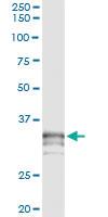 Anti-PRSS21 Antibody Pair