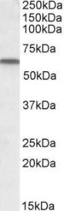 Anti-GC Antibody (A84394) (1 µg/ml) staining of Human Lung lysate (35 µg protein in RIPA buffer). Primary incubation was 1 hour. Detected by chemilu minescence