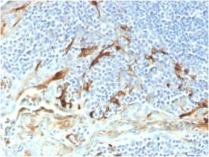 Anti-Mesothelin antibody