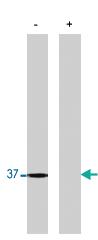 Anti-PPP1CC Polyclonal Antibody