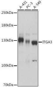 Western blot analysis of extracts of various cell lines, using Anti-Integrin alpha 3 Antibody (A308942) at 1:10000 dilution. Lysates/proteins were present at 25 µg per laneThe blocking buffer used was 3% non-fat dry milk in TBST. Detection was with a ECL Basic Kit. Exposure time: 1s