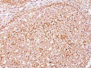 Immunohistochemical analysis of formalin-fixed, paraffin-embedded human tonsil using Anti-CD79a Antibody [HM47/A9]