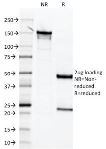 Anti-Mesothelin antibody