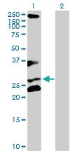 Anti-RCHY1 Rabbit Polyclonal Antibody