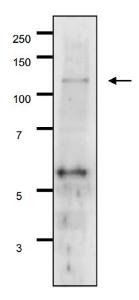 Anti-GAL11 Antibody