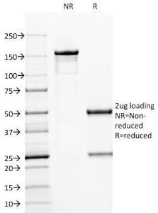 SDS-PAGE analysis of Anti-CD79a Antibody [HM47/A9] under non-reduced and reduced conditions; showing intact IgG and intact heavy and light chains, respectively. SDS-PAGE analysis confirms the integrity and purity of the antibody