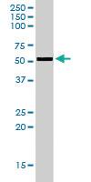 Anti-AKT3 Goat Polyclonal Antibody