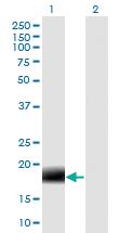 Anti-MARCH2 Mouse Monoclonal Antibody [clone: 7F3]