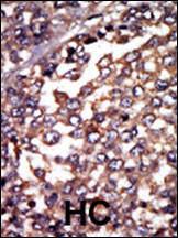 Anti-PRKAR1A Rabbit Polyclonal Antibody (Biotin)