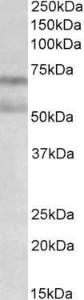 Antibody anti- cannabinoid receptor I