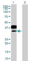 Anti-MAGEB2 Mouse Polyclonal Antibody