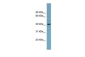 Anti-CXorf66 Rabbit Polyclonal Antibody