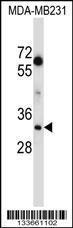 Anti-LDHA Rabbit Polyclonal Antibody (AP (Alkaline Phosphatase))