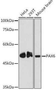 Anti-PAX6 antibody