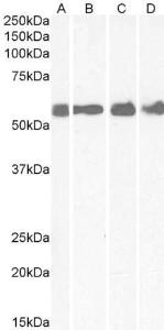 Anti-CRHR1 Antibody (A84396) (1 µg/ml) staining of Human Colon (A), Cerebellum (B), Rat Brain (C) and Mouse spinal Cord (D) lysates (35 µg protein in RIPA buffer). Detected by chemilu minescence