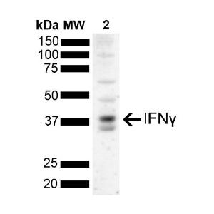 Western blot analysis of Salmon mixed lysate showing detection of Interferon gamma protein using Anti-IFN gamma Antibody [N2P2D5-A10] (A304834) at 1:1,000 for 2 hours at room temperature with shakin