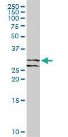 Anti-RCHY1 Rabbit Polyclonal Antibody