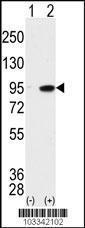 Anti-MAK Rabbit Polyclonal Antibody (HRP (Horseradish Peroxidase))