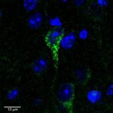 Confocal image (3µm) of Anti-CRHR1 Antibody (A84396) (0.3 µg/ml) staining in green a dendrite of a neuronal cell in C57 mouse cortex. Counter-stained with DAPI (in blue)