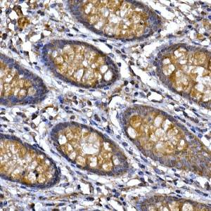 Immunohistochemistry analysis of paraffin-embedded human colon tissue using Anti-PPP1R3C Antibody (A307722) at a dilution of 1:50 (40X lens). Perform high pressure antigen retrieval with 10 mM citrate buffer pH 6.0 before commencing with IHC staining protocol