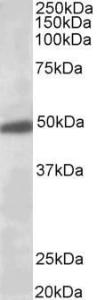 Anti-KCNJ6 antibody