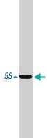 Anti-PPP2R2A Polyclonal Antibody