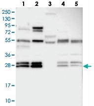 Anti-C10ORF67 Rabbit Polyclonal Antibody