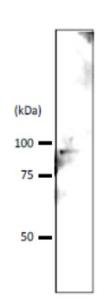 Anti-Srb4p Antibody