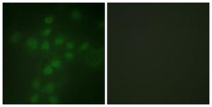 Immunofluorescence analysis of HUVEC cells using Anti-Telomerase (phospho Ser227) Antibody. The right hand panel represents a negative control, where the antibody was pre-incubated with the immunising peptide.